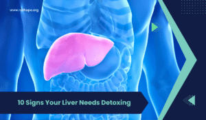 10 Signs Your Liver Needs Detoxing