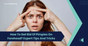 How To Get Rid Of Pimples On Forehead